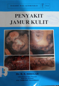 Image of Penyakit jamur kulit